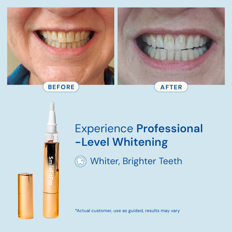 SmileFit Pro Whitening Serum