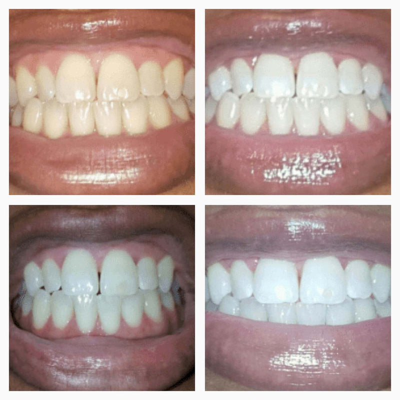 SmileFit Pro Whitening Serum