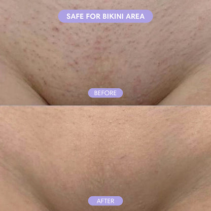 SmoothSkin Crystal Eraser